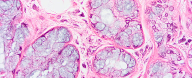 Glándula Salival