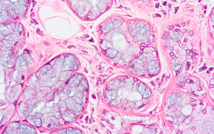 Glándula Salival